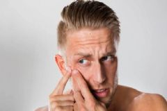 男人該怎么護膚？男人護膚有何誤區(qū)？[圖]