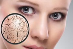 干性皮膚怎么補水？干性皮膚用什么卸妝油？[圖]