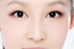 內(nèi)吸去眼袋好不好？內(nèi)吸去眼袋術(shù)后有什么注意事項？[圖]