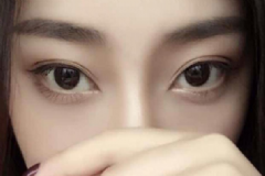 雙眼皮貼怎么貼自然？怎么正確使用雙眼皮貼？[圖]