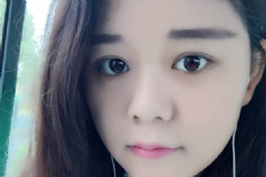 腫眼泡如何做雙眼皮？雙眼皮術(shù)后消腫怎么做？[圖]