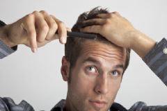 男人防脫發(fā)的妙招有哪些？男人防脫發(fā)吃什么最好？[圖]