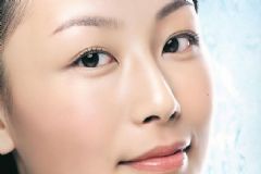 臉上為何會長痘？女性祛痘有何方法？[圖]