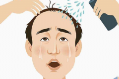 男人脫發(fā)吃什么能調(diào)理？男人脫發(fā)吃什么好呢？[圖]