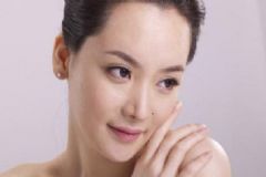 鼻尖整形有何材料？鼻尖整形要注意什么？[圖]