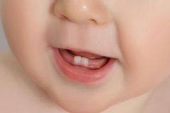 如何減少寶寶長牙痛苦？寶寶長牙牙疼怎么緩解？[圖]
