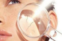 秋冬皮膚干燥怎么辦？秋冬皮膚易干燥如何增加水分？[圖]