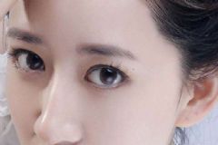 雙眼皮什么時候割最好？割雙眼皮有遺癥嗎？[圖]