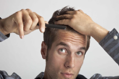 男性治療脫發(fā)的誤區(qū)有哪些？男人如何正確洗發(fā)護(hù)發(fā)？[圖]