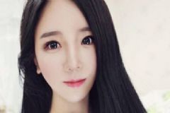 唇部整形恢復(fù)期長(zhǎng)嗎？唇部整形要注意什么？[圖]