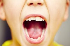 寶寶換牙期如何護(hù)理？寶寶換牙要注意些什么？[圖]
