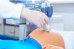 女性孕期為什么會(huì)腰疼？女性孕期腰疼是因?yàn)槭裁?？[圖]