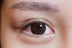 長脂肪粒和眼霜有關(guān)系嗎？對眼霜的誤解很深很深[圖]