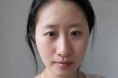 為什么敷完面膜臉上搓泥？敷完面膜臉上搓泥怎么辦？[圖]
