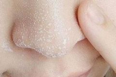 如何用牙膏去除黑頭？怎樣用牙膏去除黑頭？[圖]