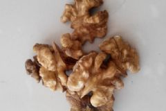 吃核桃對(duì)膽結(jié)石好嗎？膽結(jié)石能吃核桃嗎？[多圖]