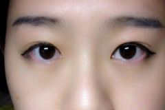 哪些美瞳比較流行？初戴有哪些美瞳注意事項？[圖]