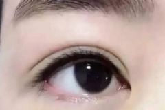美瞳線對(duì)眼睛有什么壞處？美瞳線對(duì)眼睛有副作用嗎？[圖]