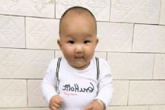 引起嬰兒濕疹的病因是什么？怎樣護(hù)理預(yù)防嬰兒濕疹[圖]