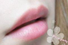 嘴唇干裂是什么原因？為什么嘴唇會(huì)干裂？[圖]