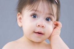 小孩子如何去掉黑眼圈？小孩子怎么會(huì)有黑眼圈？[圖]