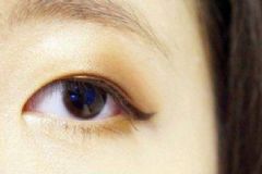 女生如何消除泡泡眼？女生怎么消除腫眼泡？[圖]
