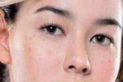 中藥?kù)畎叻椒ㄓ心男?？有哪些飲品能幫助祛斑？[圖]