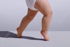 幼兒八字腳的原因有哪些？預(yù)防幼兒八字腳要注意什么？[圖]