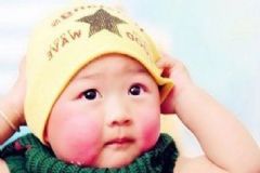 冬季寶寶如何遠離紅臉蛋？寶寶冬天紅臉蛋的原因有哪些？[圖]