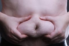 縮胃手術(shù)費(fèi)用是多少？縮胃手術(shù)效果怎么樣？[圖]