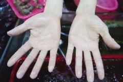 手沾水就容易發(fā)皺怎么辦？怎樣做可以避免手泡水時(shí)發(fā)漲[多圖]