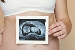 孕期如何治療子宮肌瘤？中醫(yī)治療子宮肌瘤的秘方是什么？[圖]