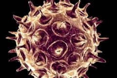帶狀皰疹分為哪些類型？怎樣針對(duì)治療帶狀孢疹[圖]