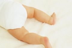 夏天如何使用尿不濕？如何趕走寶寶紅屁屁？[圖]
