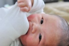 熱性蕁麻疹的患病原因是什么？怎樣預(yù)防熱性蕁麻疹[圖]