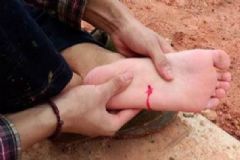 腳被釘子扎了會中風(fēng)嗎？腳被釘子扎了怎么包扎？[圖]