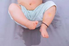 小孩容易尿床是什么原因？如何糾正小孩尿床的現(xiàn)象？[圖]