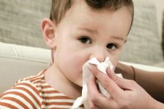 上火鼻子出血怎么治療？上火鼻子出血食療吃什么？[圖]