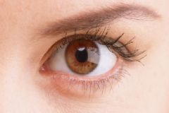 眼睛有分泌物是什么原因?qū)е碌?？眼睛有分泌物是什么病？[圖]