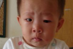 怎么預(yù)防眼睛長針眼？哪些原因會導致長針眼？[圖]