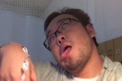 哪些年輕人容易腦梗塞？預(yù)防腦梗塞的方法有哪些？[圖]