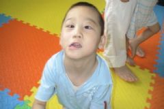 輕度腦癱是什么疾病？輕度腦癱的癥狀是什么？[圖]