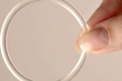 女性宮內(nèi)節(jié)育器有哪幾種？宮內(nèi)節(jié)育器哪種好？[圖]