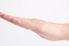 肝掌一定是肝病嗎？肝病就是肝硬化嗎？[圖]