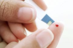 糖尿病患者都需要做哪些檢查？糖尿病的檢查怎么做？[圖]