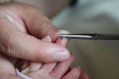 剪指甲長到肉里怎么辦？剪指甲往肉里長怎么處理？[圖]