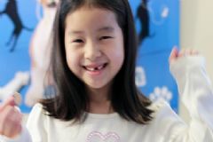 小孩換牙到幾歲結束？小孩換牙幾歲換完？[圖]