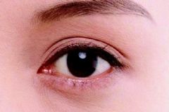 女性最易患哪些眼科疾病？女性不同時(shí)期如何保護(hù)眼睛？[圖]