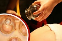 中醫(yī)拔罐減肥穴位有哪些？拔罐減肥適應(yīng)人群有哪些？[圖]