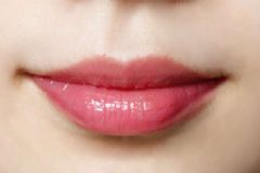 漂唇后嘴唇發(fā)黑怎么辦？漂唇后發(fā)黑是什么原因？[圖]